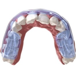 AQUALIZER gouttière dentition slim 2mm medium