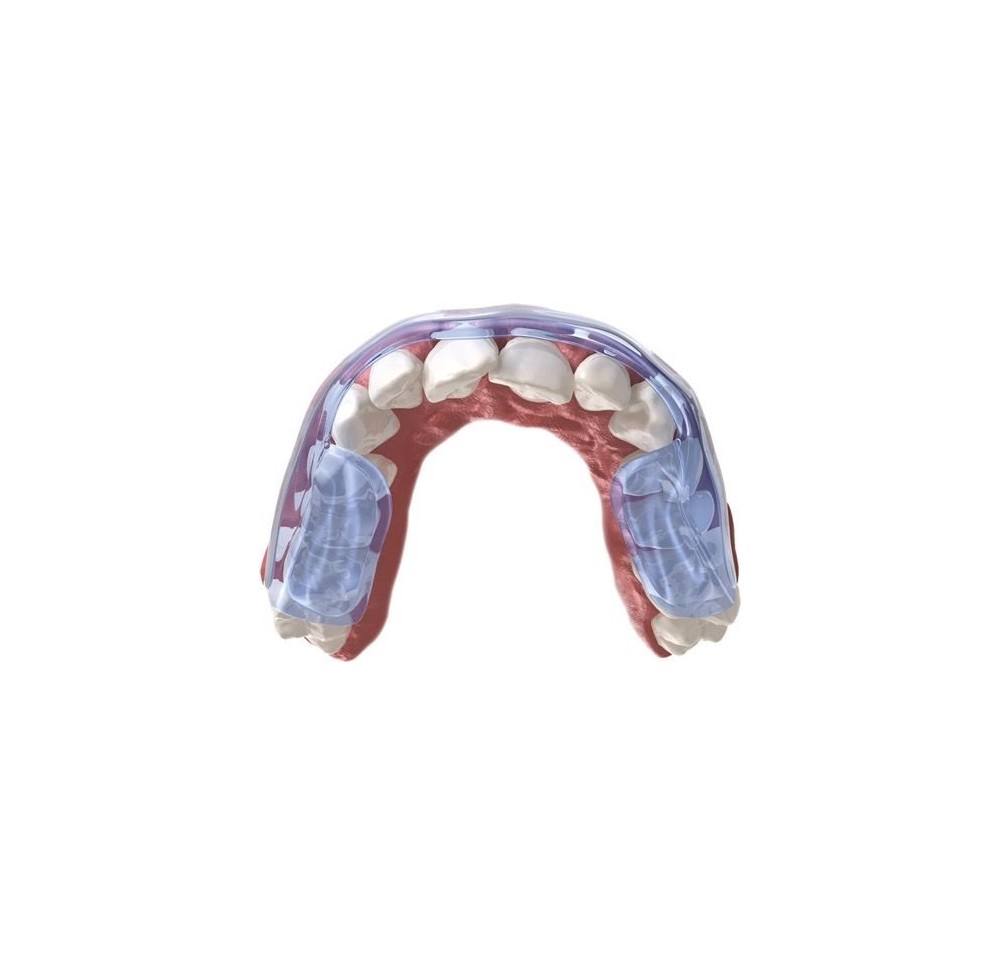 AQUALIZER gouttière dentition ultra 3mm high