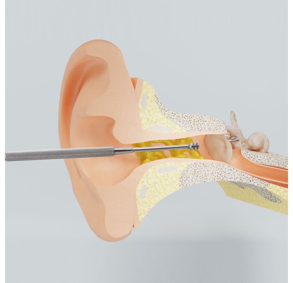 REUSEME outil de nettoyage d'oreille