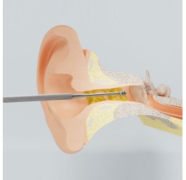 REUSEME outil de nettoyage d'oreille
